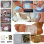Ayak Detox Bandı 10 Adet - Görsel 2