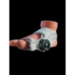 Ayak Baş Parmak Kemik Düzeltici Halluks Valgus - Görsel 2